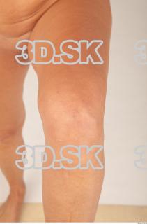 Knee texture of Marjorie 0002